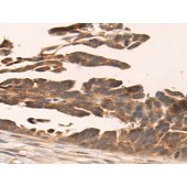 Solarbio K009902P Anti-INHBA Polyclonal Antibody