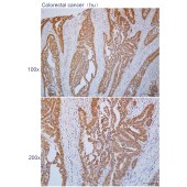 Solarbio K112279P Anti-CPB2 Polyclonal Antibody