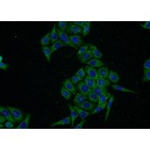 Solarbio K009776P Anti-ACRV1 Polyclonal Antibody