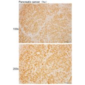 Solarbio K110513P Anti-POLR3K Polyclonal Antibody