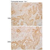 Solarbio K110015P Anti-PRKN Polyclonal Antibody