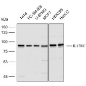 Solarbio K112425P Anti-IL17RC Polyclonal Antibody