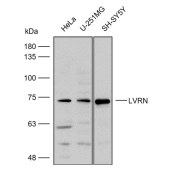 Solarbio K112307P Anti-LVRN Polyclonal Antibody
