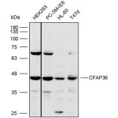 Solarbio K110492P Anti-CFAP36 Polyclonal Antibody