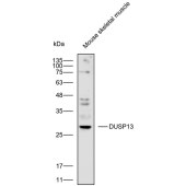 Solarbio K112411P Anti-DUSP13 Polyclonal Antibody