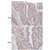 Solarbio K110495P Anti-NETO2 Polyclonal Antibody