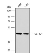 Solarbio K009871P Anti-GLT8D1 Polyclonal Antibody