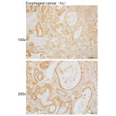 Solarbio K110005P Anti-ANGPTL7 Polyclonal Antibody