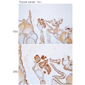 Solarbio K112298P Anti-ACAA2 Polyclonal Antibody