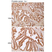 Solarbio K112194P Anti-CLIP1 Polyclonal Antibody