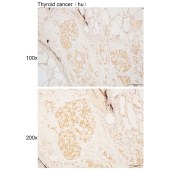 Solarbio K110498P Anti-ACTN1 Polyclonal Antibody