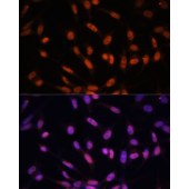 Solarbio K009397P Anti-TWIST1 Rabbit Polyclonal Antibody