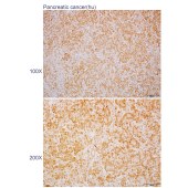 Solarbio K110460P Anti-CSTF2T Polyclonal Antibody