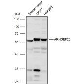 Solarbio K110033P Anti-ARHGEF25 Polyclonal Antibody