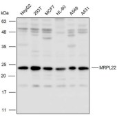 Solarbio K110290P Anti-MRPL22 Polyclonal Antibody