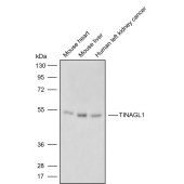 Solarbio K009815P Anti-TINAGL1 Polyclonal Antibody