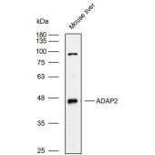 Solarbio K110003P Anti-ADAP2 Polyclonal Antibody