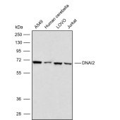 Solarbio K009867P Anti-DNAI2 Polyclonal Antibody