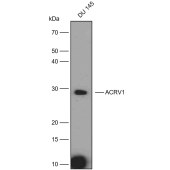 Solarbio K009776P Anti-ACRV1 Polyclonal Antibody