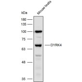 Solarbio K110376P Anti-DYRK4 Polyclonal Antibody
