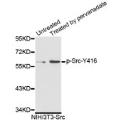 Solarbio K006219P Anti-Phospho-SRC Family-Y416 ETS1 Rabbit Polyclonal Antibody