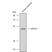 Solarbio K009835P Anti-GRWD1 Polyclonal Antibody