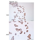 Solarbio K112213P Anti-RAB11B Polyclonal Antibody