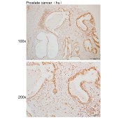 Solarbio K110051P Anti-KAT7 Polyclonal Antibody