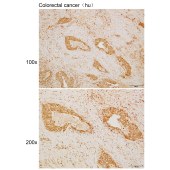 Solarbio K110117P Anti-CYFIP1 Polyclonal Antibody