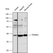 Solarbio K112223P Anti-TRIM43 Polyclonal Antibody