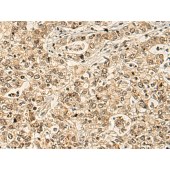 Solarbio K009802P Anti-RGS6 Polyclonal Antibody