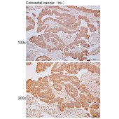 Solarbio K110351P Anti-DPP8 Polyclonal Antibody