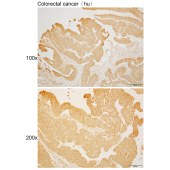 Solarbio K110489P Anti-ZNF267 Polyclonal Antibody