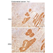 Solarbio K109959P Anti-KRT8 Polyclonal Antibody