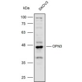 Solarbio K110320P Anti-OPN3 Polyclonal Antibody