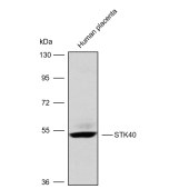 Solarbio K009795P Anti-STK40 Polyclonal Antibody