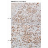 Solarbio K110488P Anti-WWP2 Polyclonal Antibody