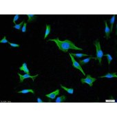 Solarbio K009465P Anti-HSP70 Polyclonal Antibody