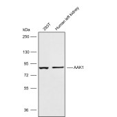 Solarbio K009899P Anti-AAK1 Polyclonal Antibody