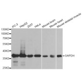 Solarbio K006151P Anti-GAPDH Polyclonal Antibody