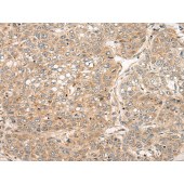 Solarbio K009824P Anti-PRXL2B Polyclonal Antibody