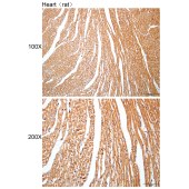 Solarbio K112417P Anti-ACTN2 Polyclonal Antibody