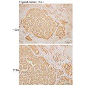 Solarbio K109955P Anti-LKB1 Polyclonal Antibody