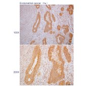 Solarbio K110463P Anti-EPHB4 Polyclonal Antibody