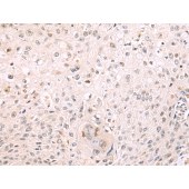 Solarbio K009818P Anti-DECR2 Polyclonal Antibody