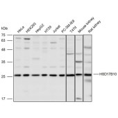 Solarbio K110131P Anti-HSD17B10 Polyclonal Antibody
