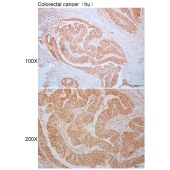 Solarbio K110325P Anti-CHST8 Polyclonal Antibody