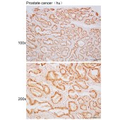 Solarbio K110355P Anti-NRIP1 Polyclonal Antibody
