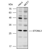 Solarbio K110470P Anti-STOML3 Polyclonal Antibody