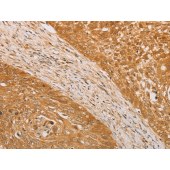 Solarbio K009795P Anti-STK40 Polyclonal Antibody